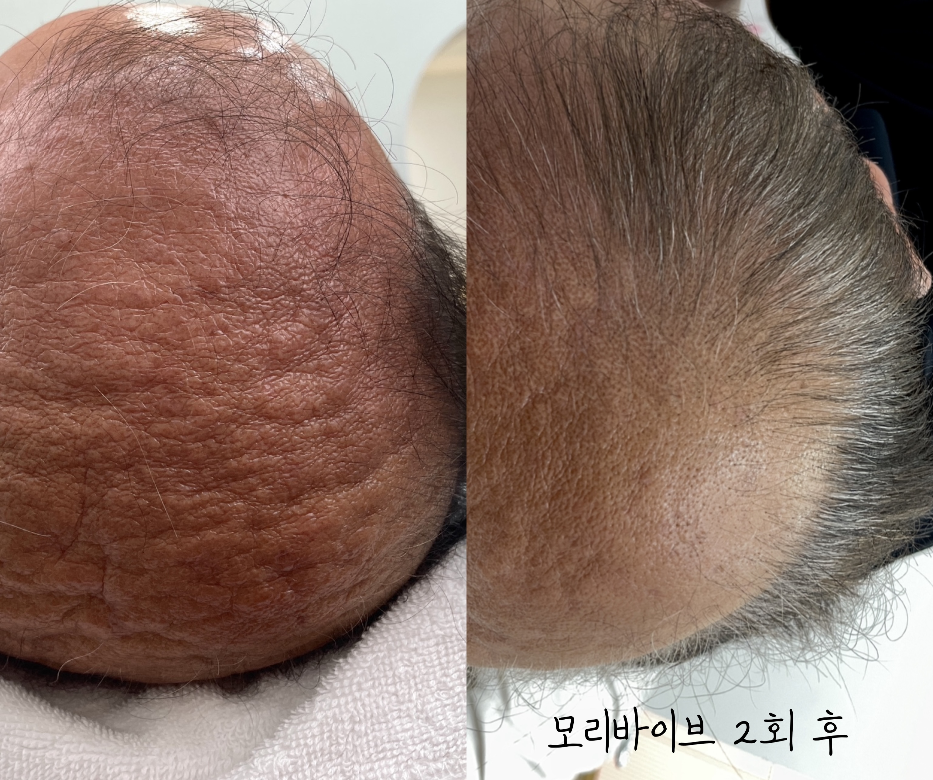 모리바이브 홍대점 대표 이미지