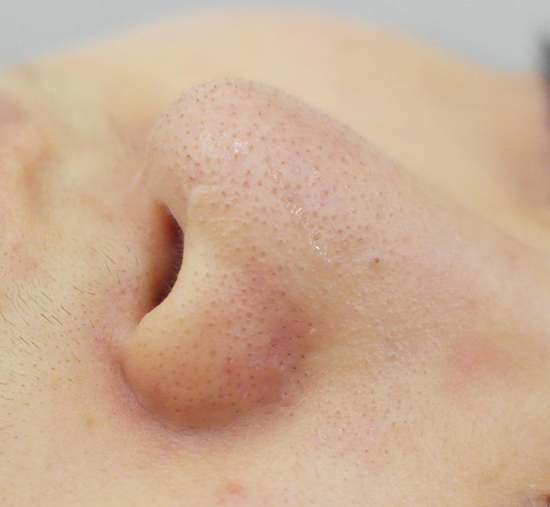 블랙헤드 코피다 대표 이미지