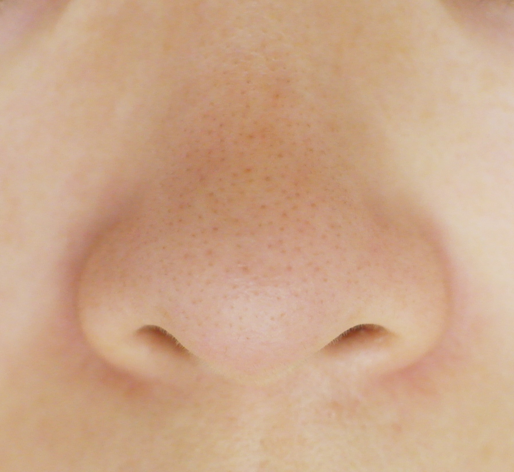 블랙헤드 코피다 대표 이미지