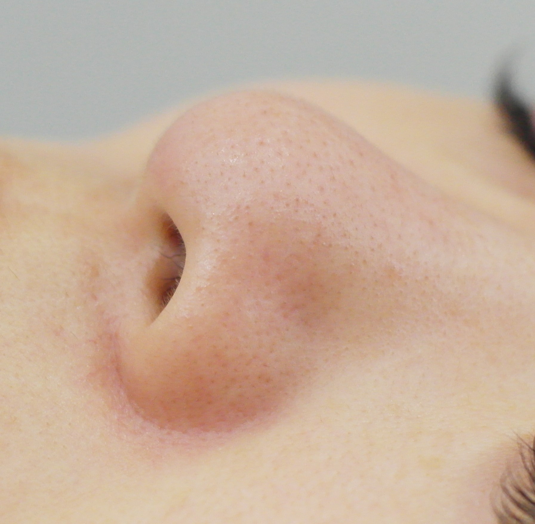 블랙헤드 코피다 대표 이미지