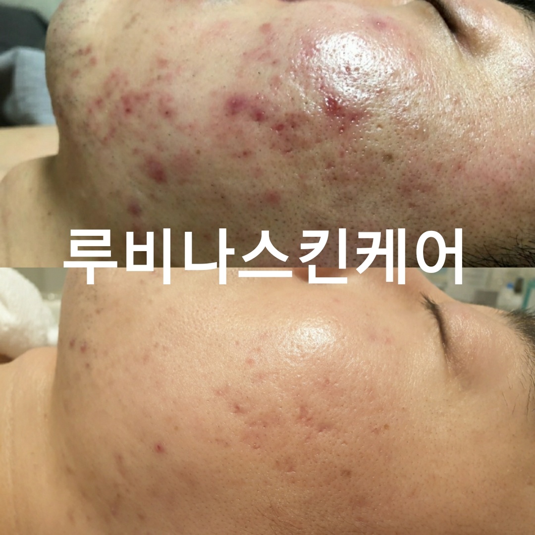 루비나 피부&바디 대표 이미지