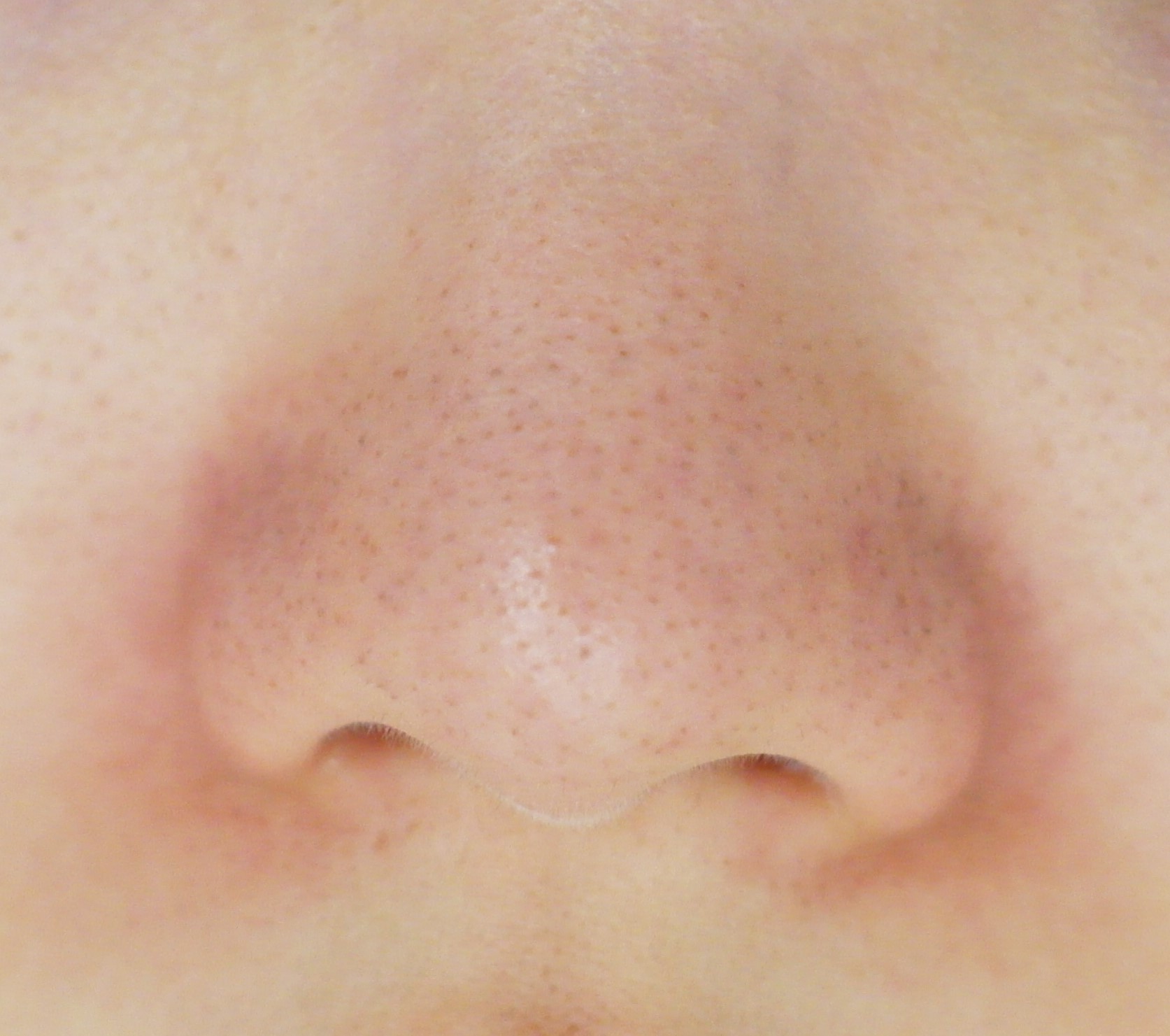 블랙헤드 코피다 대표 이미지