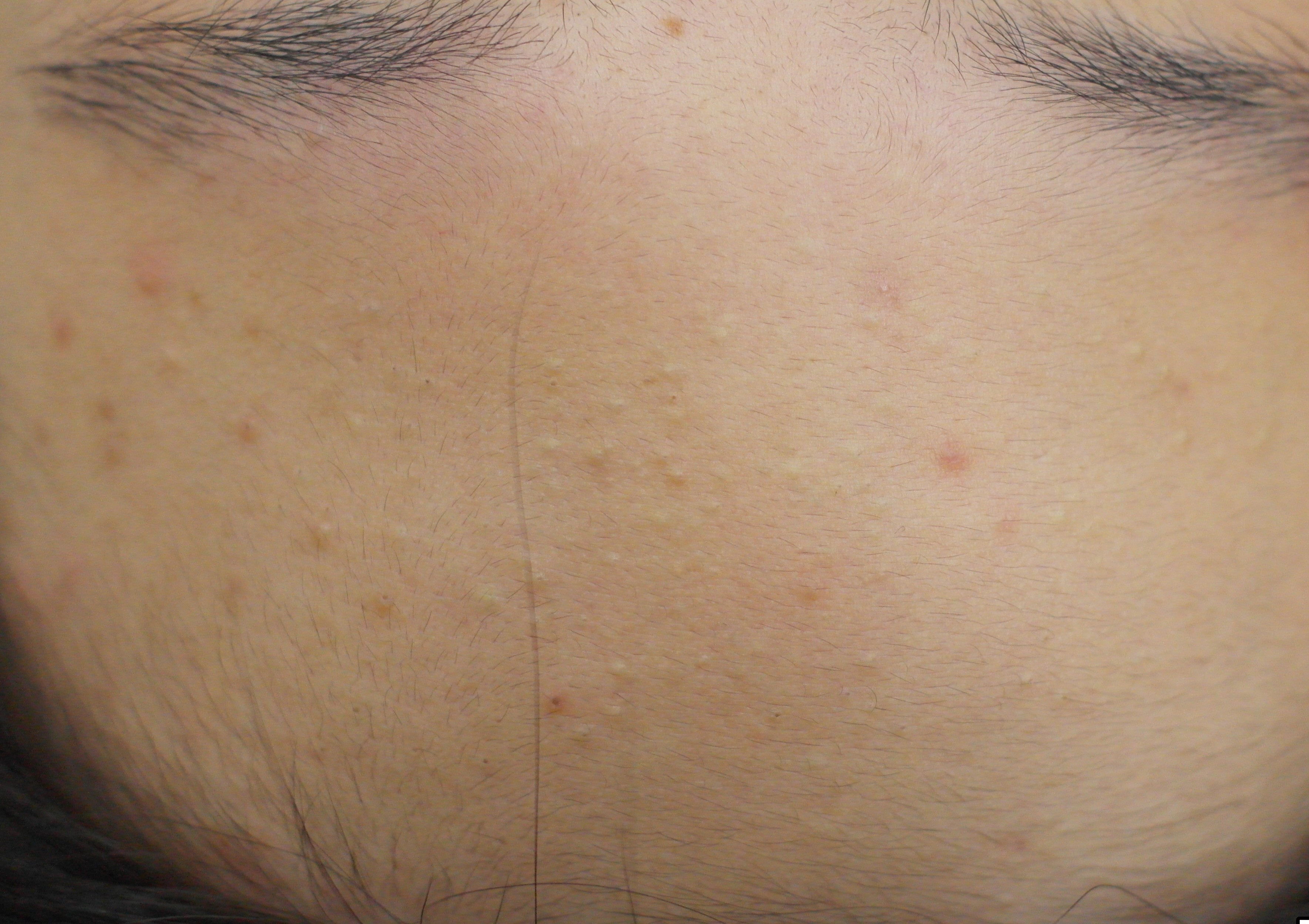 블랙헤드 코피다 신도림 대표 이미지