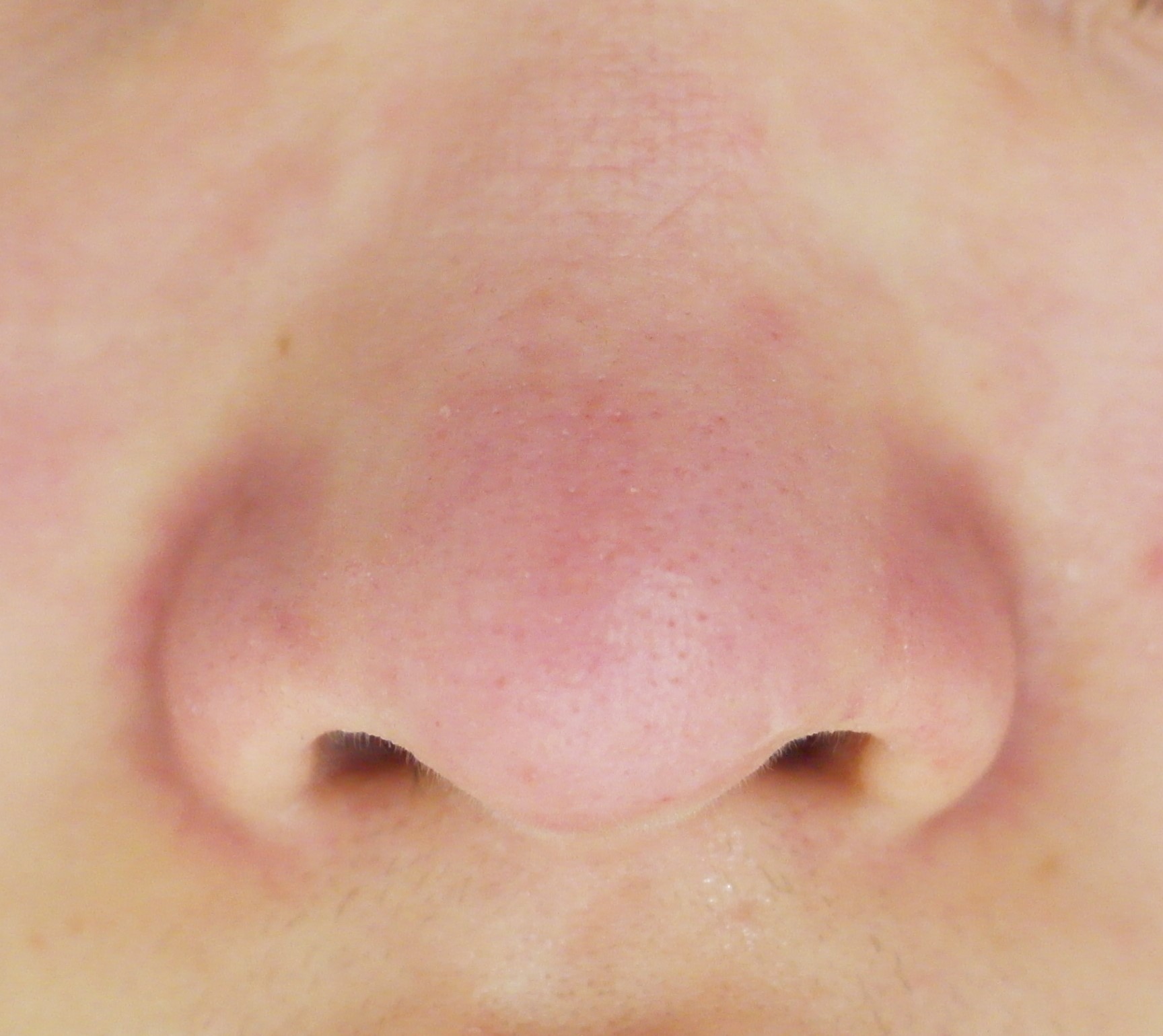 블랙헤드 코피다 대표 이미지