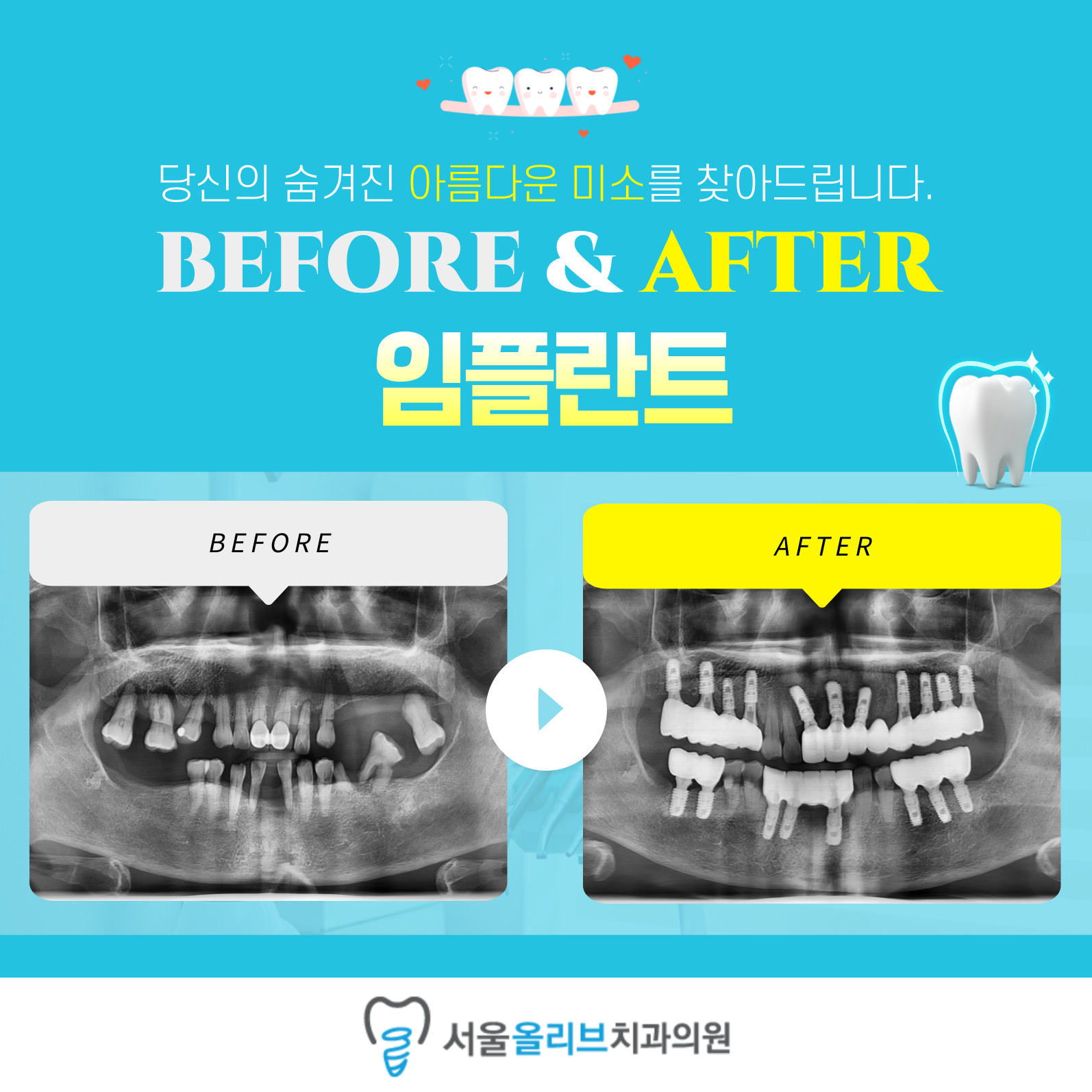 서울올리브치과의원 대표 이미지