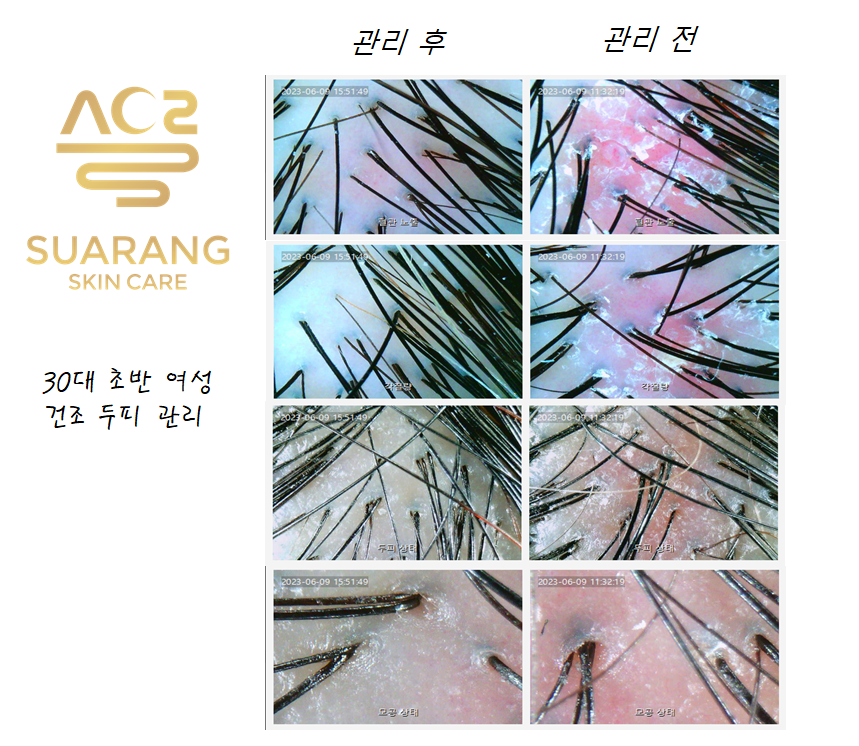 수아랑스킨케어