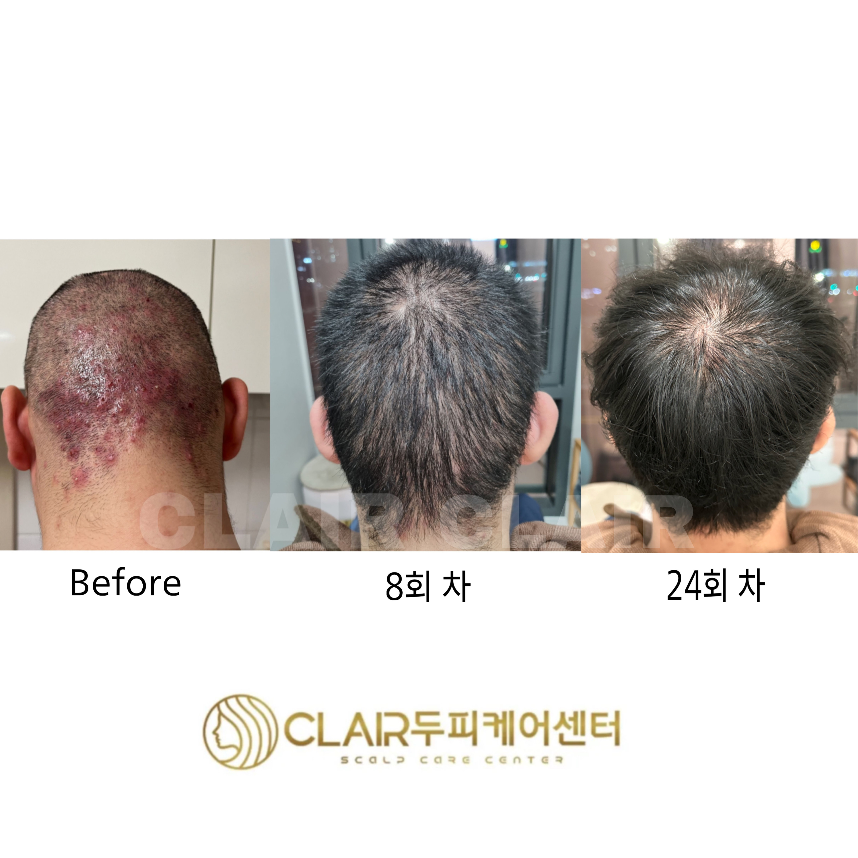 클레르두피케어센터 대표 이미지