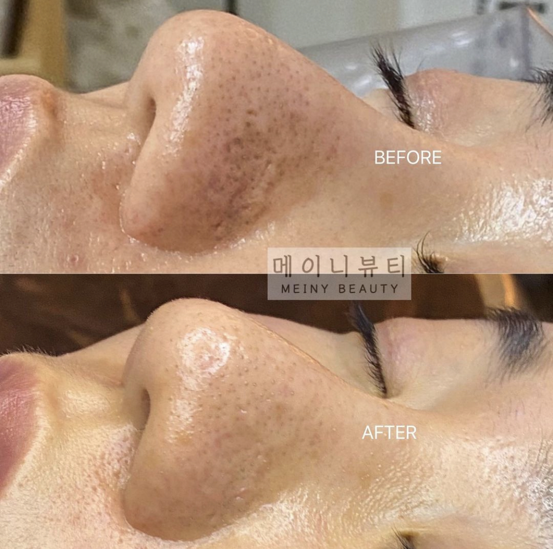 메이니뷰티