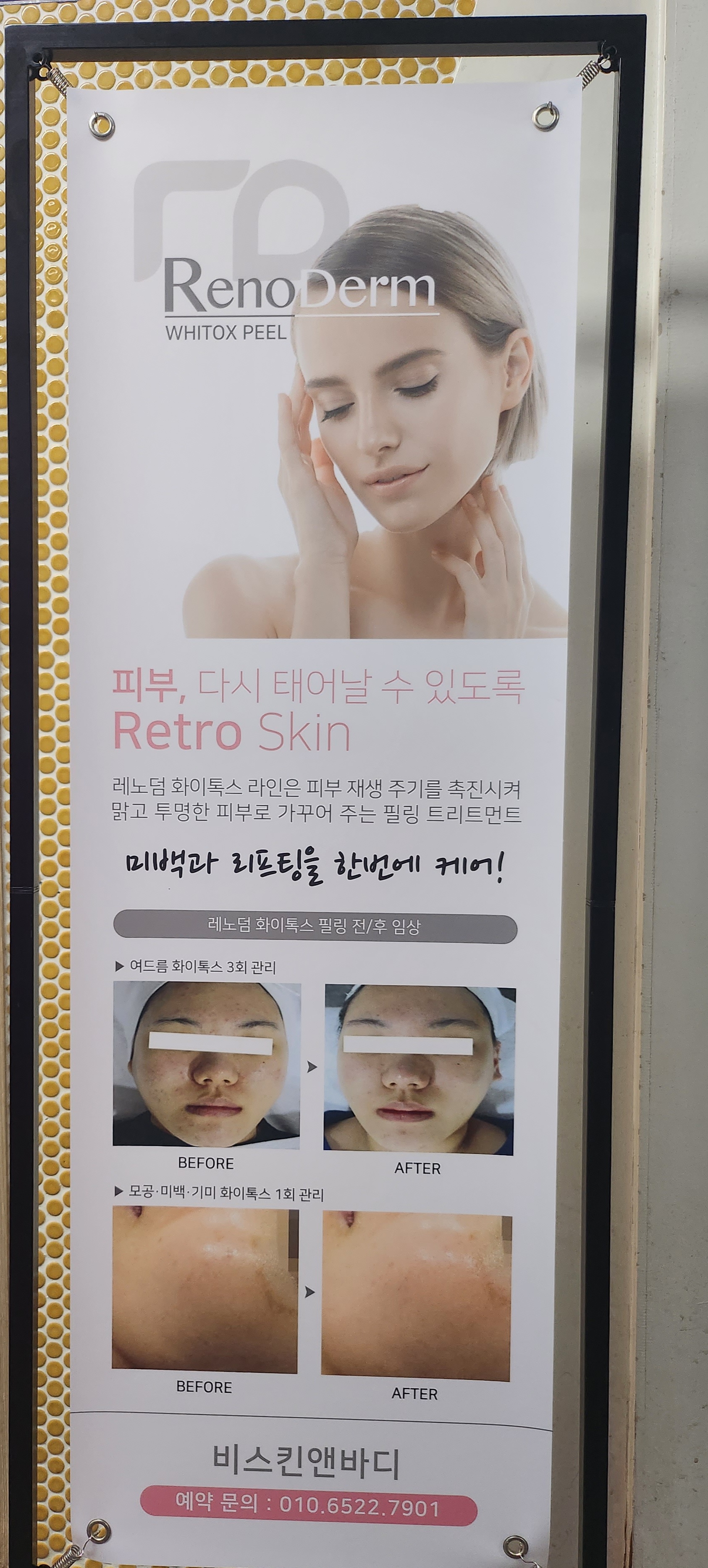 B스킨 앤 바디