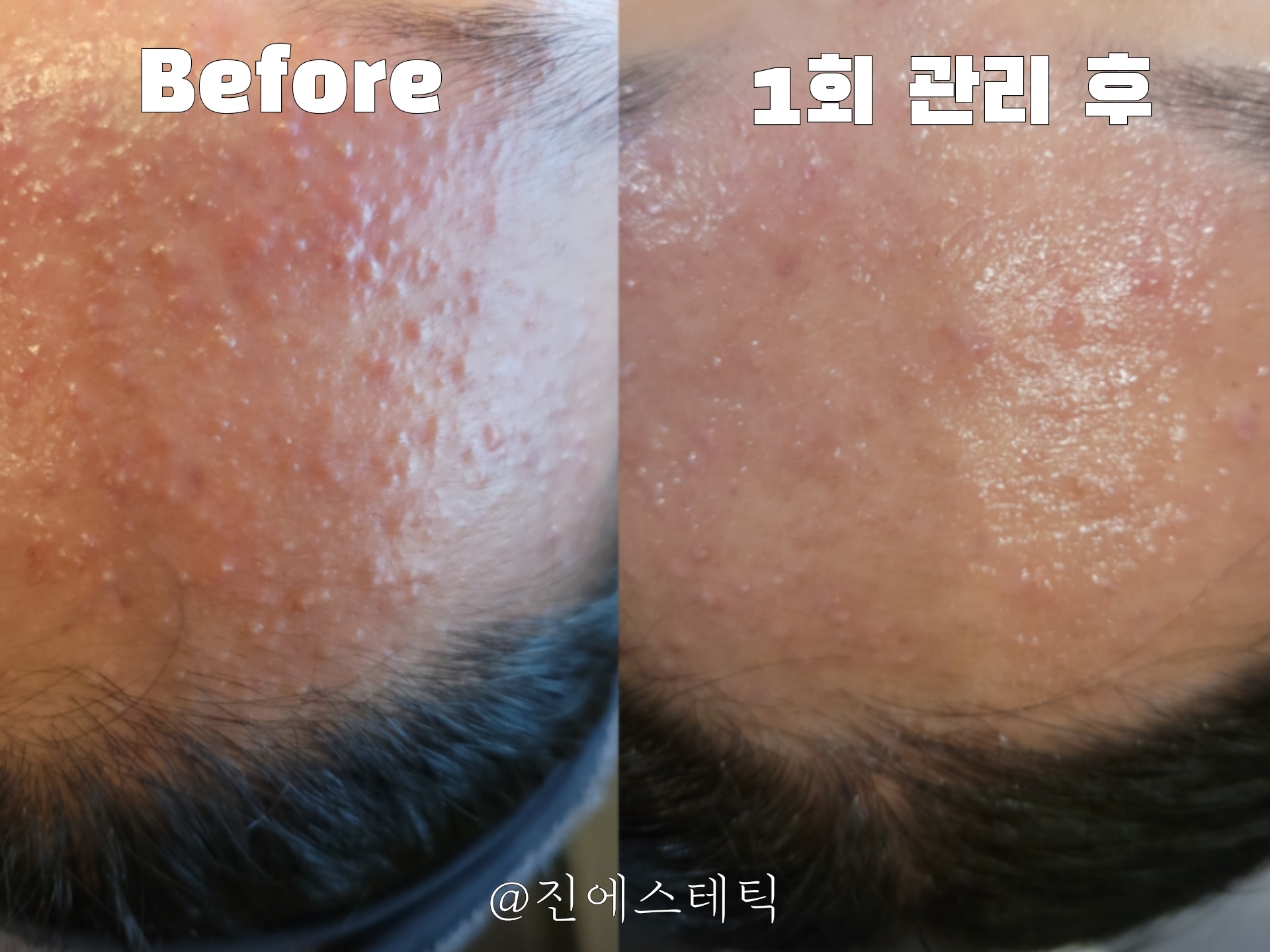 진에스테틱 대표 이미지