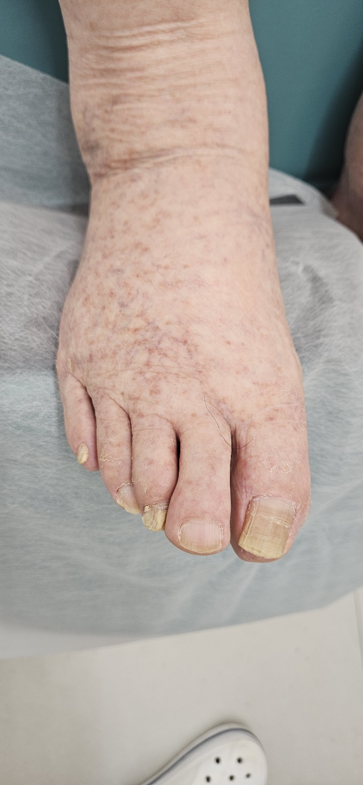 풋네일&문제성발톱 페디크루 대표 이미지