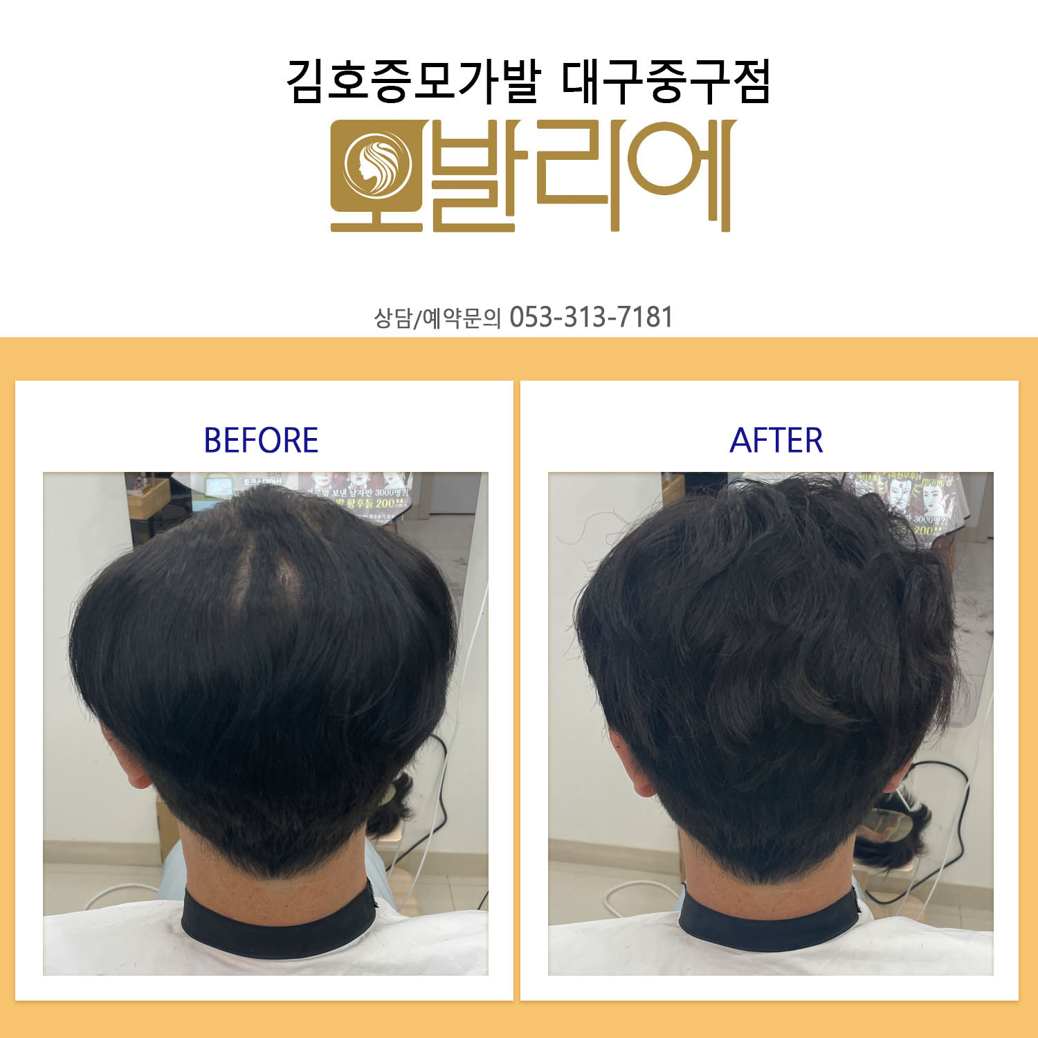 모발리에 대표 이미지