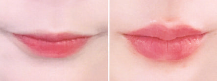 리프업의원 대표 이미지