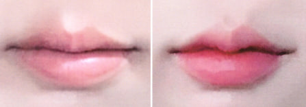 리프업의원 대표 이미지