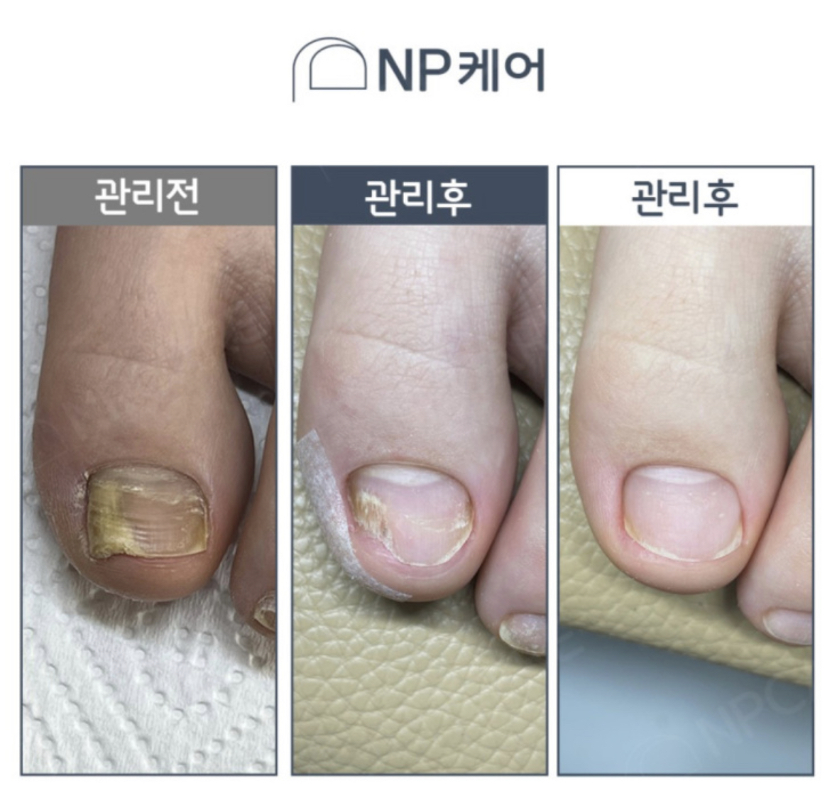 엔피케어 부산연산점
