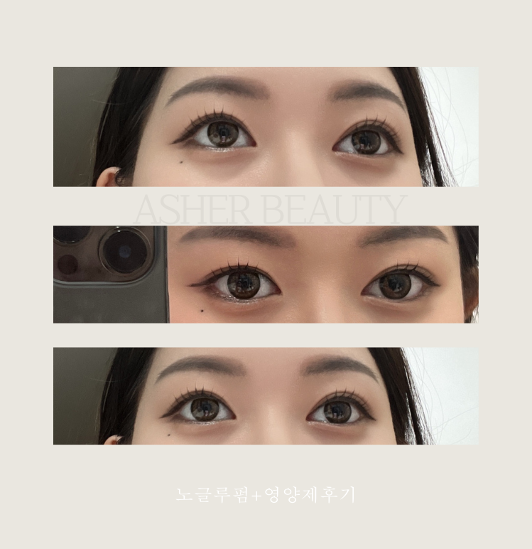 아셀뷰티