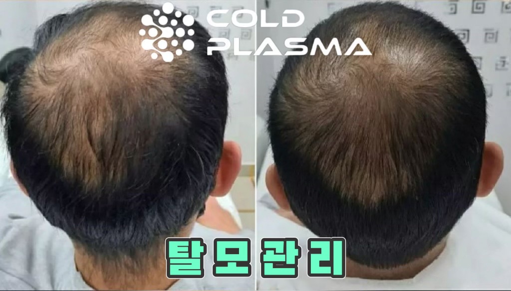 뷰티수 대표 이미지
