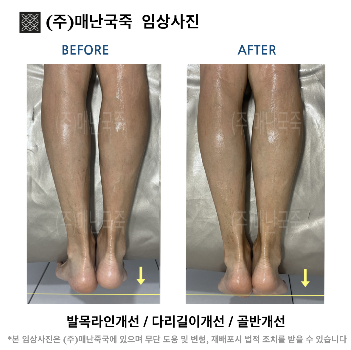 단미스킨앤바디