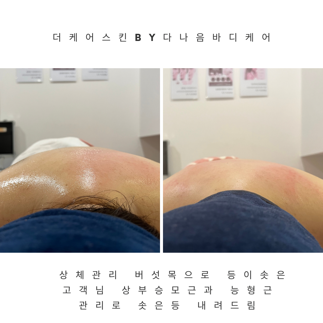 더케어스킨