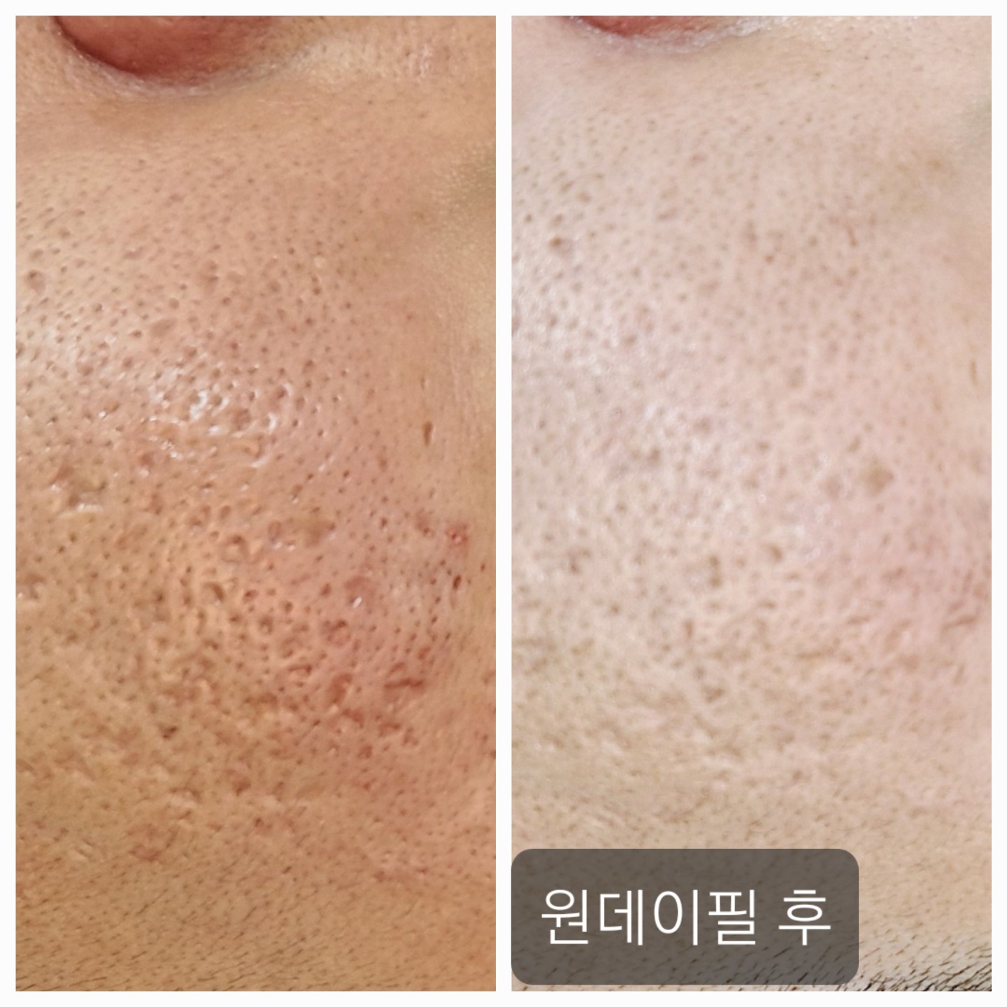 피어나 뷰티 청량리점 대표 이미지