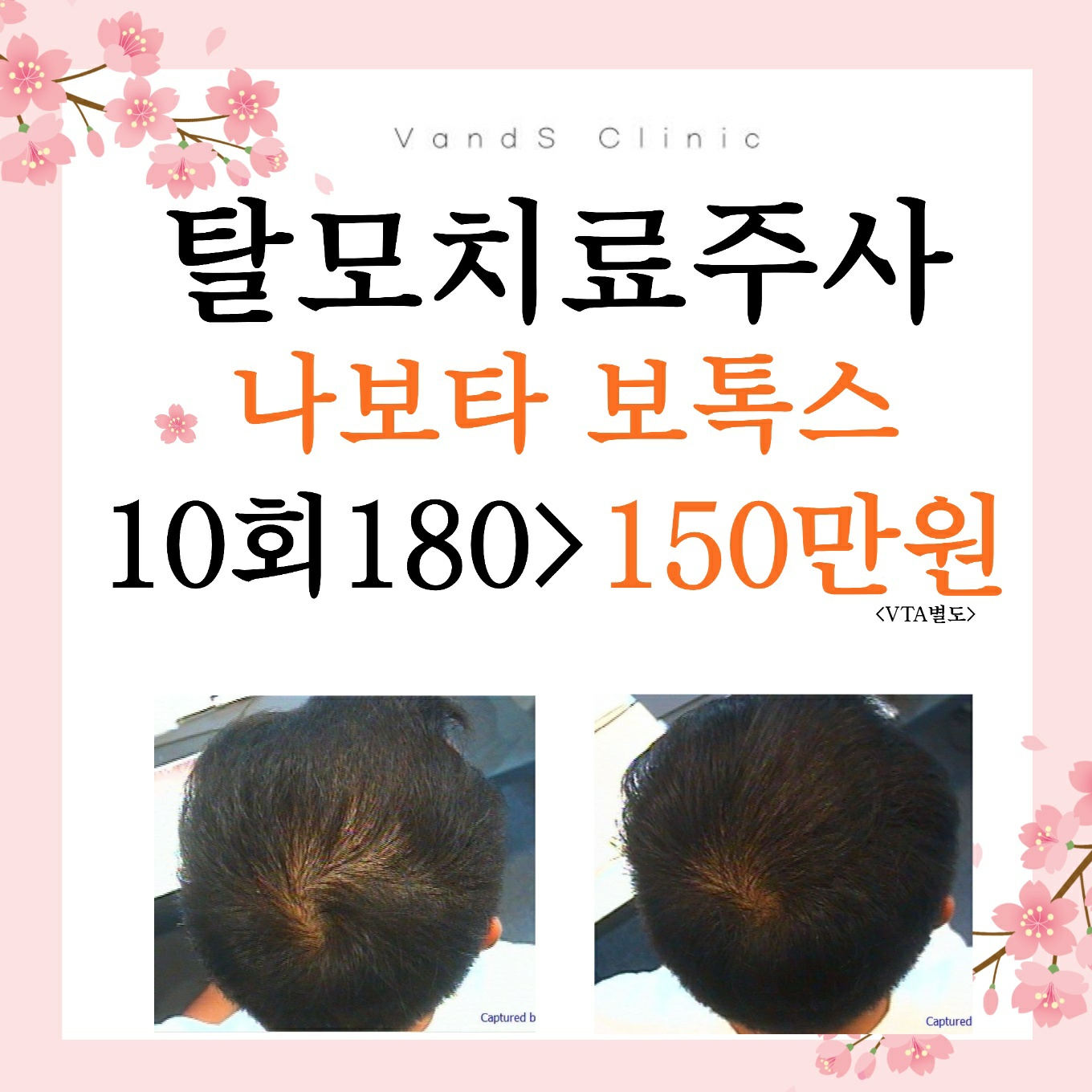 동탄 밴스 탈모케어 대표 이미지