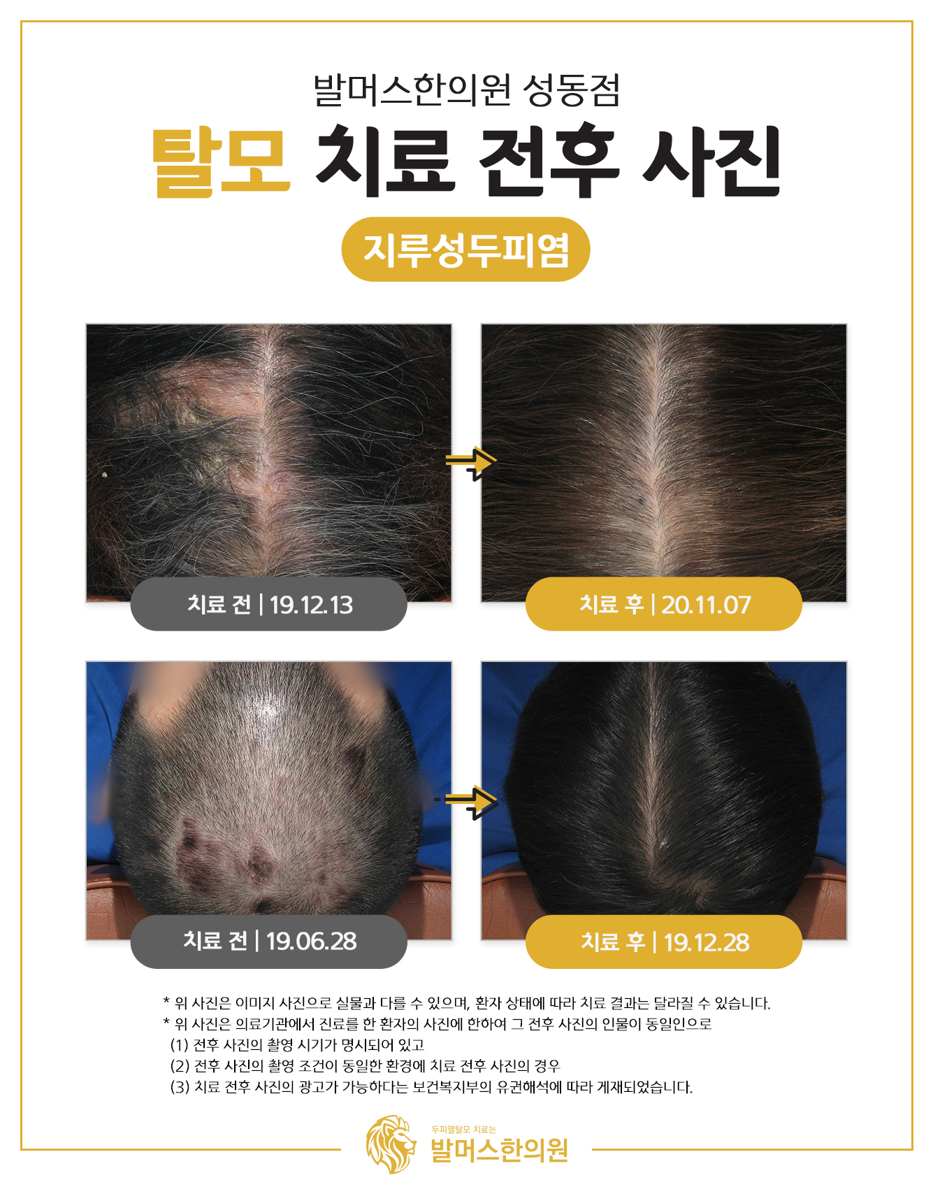 발머스한의원 종로성동 대표 이미지