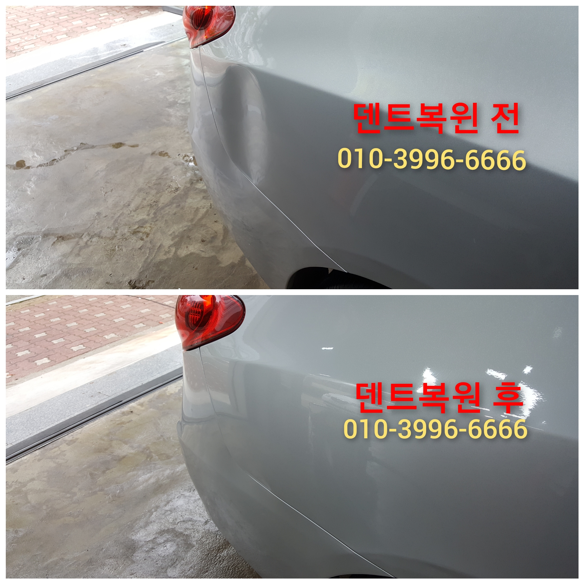 와니덴트