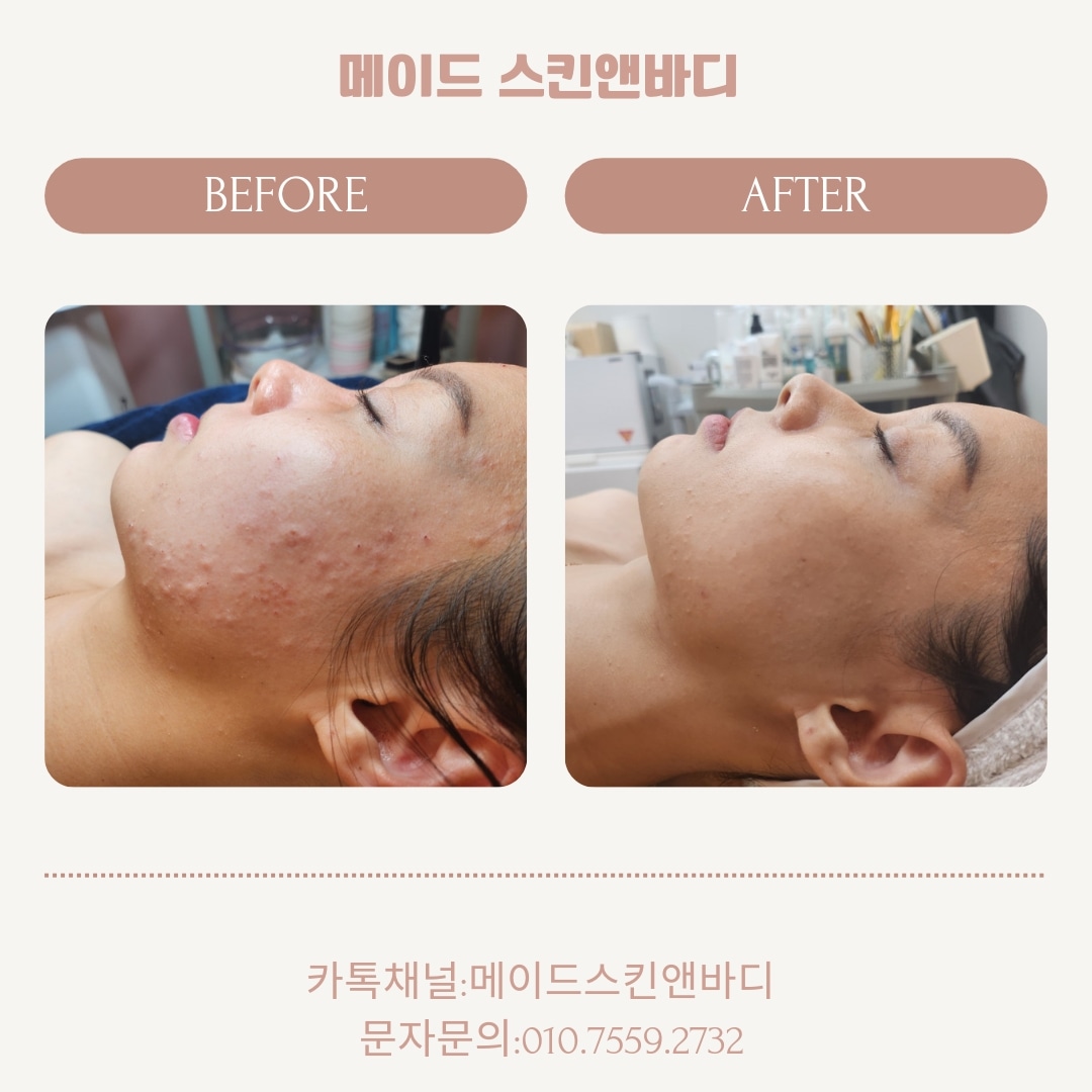 메이드 스킨앤바디