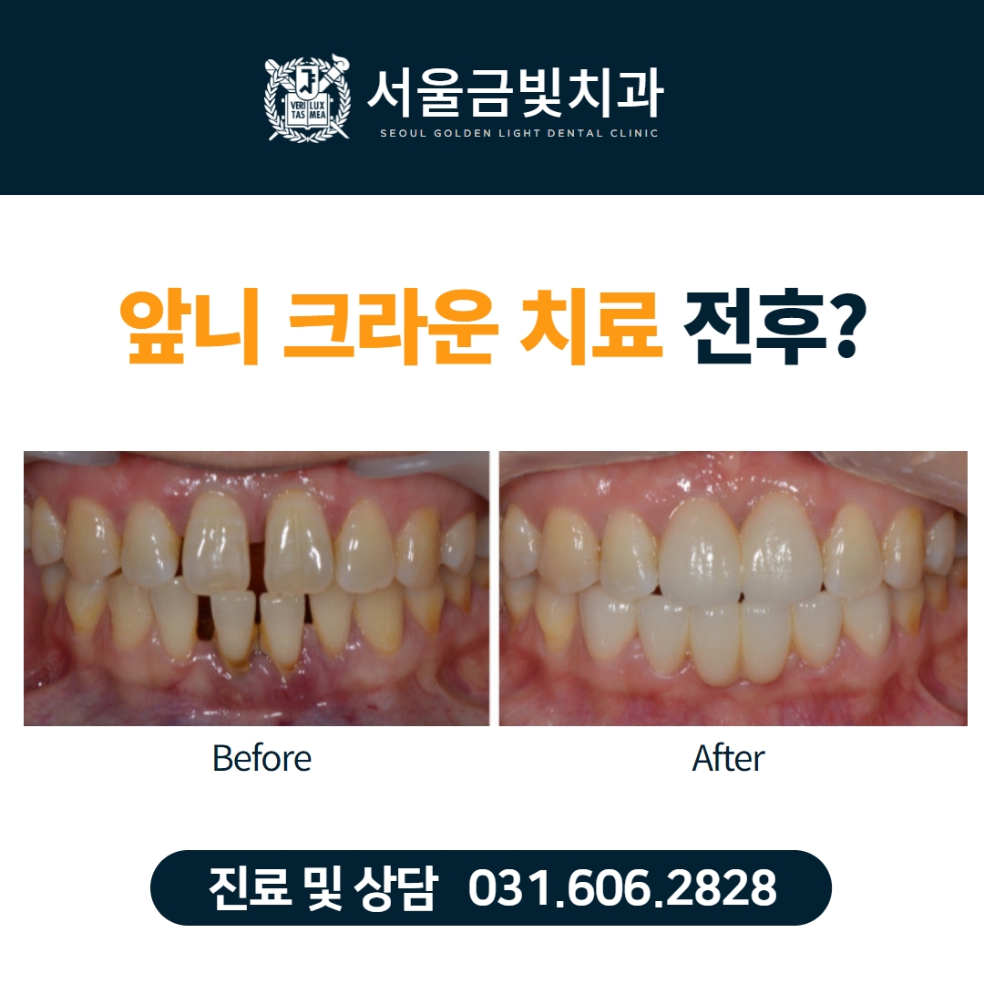 서울금빛치과의원 대표 이미지