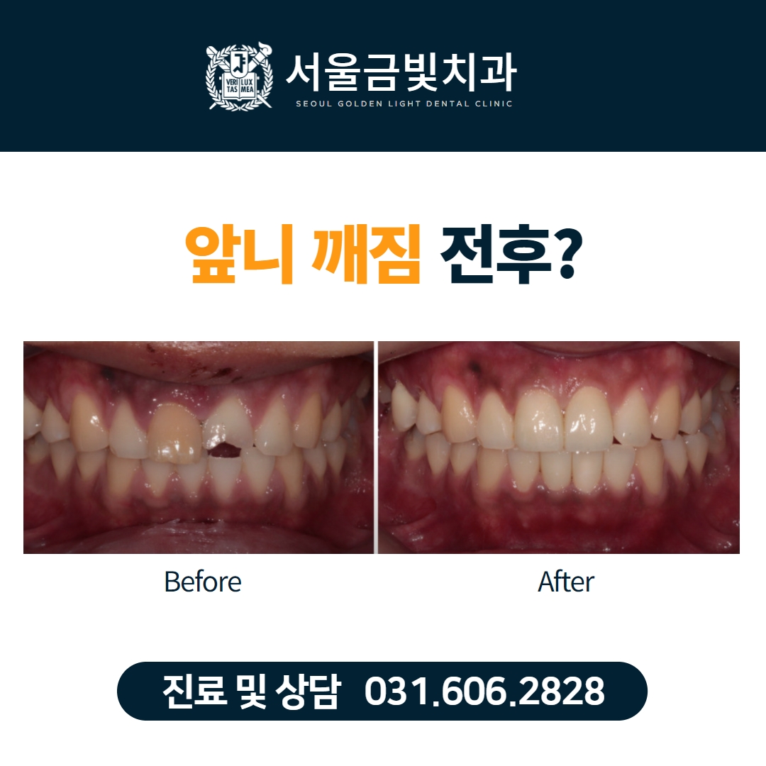 서울금빛치과의원 대표 이미지