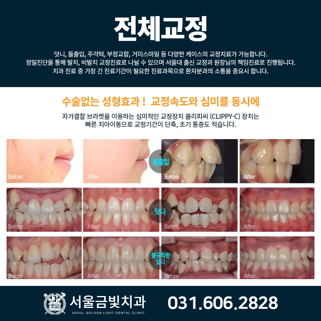 서울금빛치과의원 대표 이미지