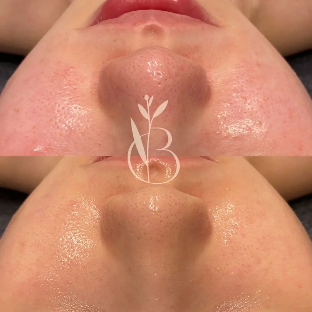 뷰티온리 대표 이미지