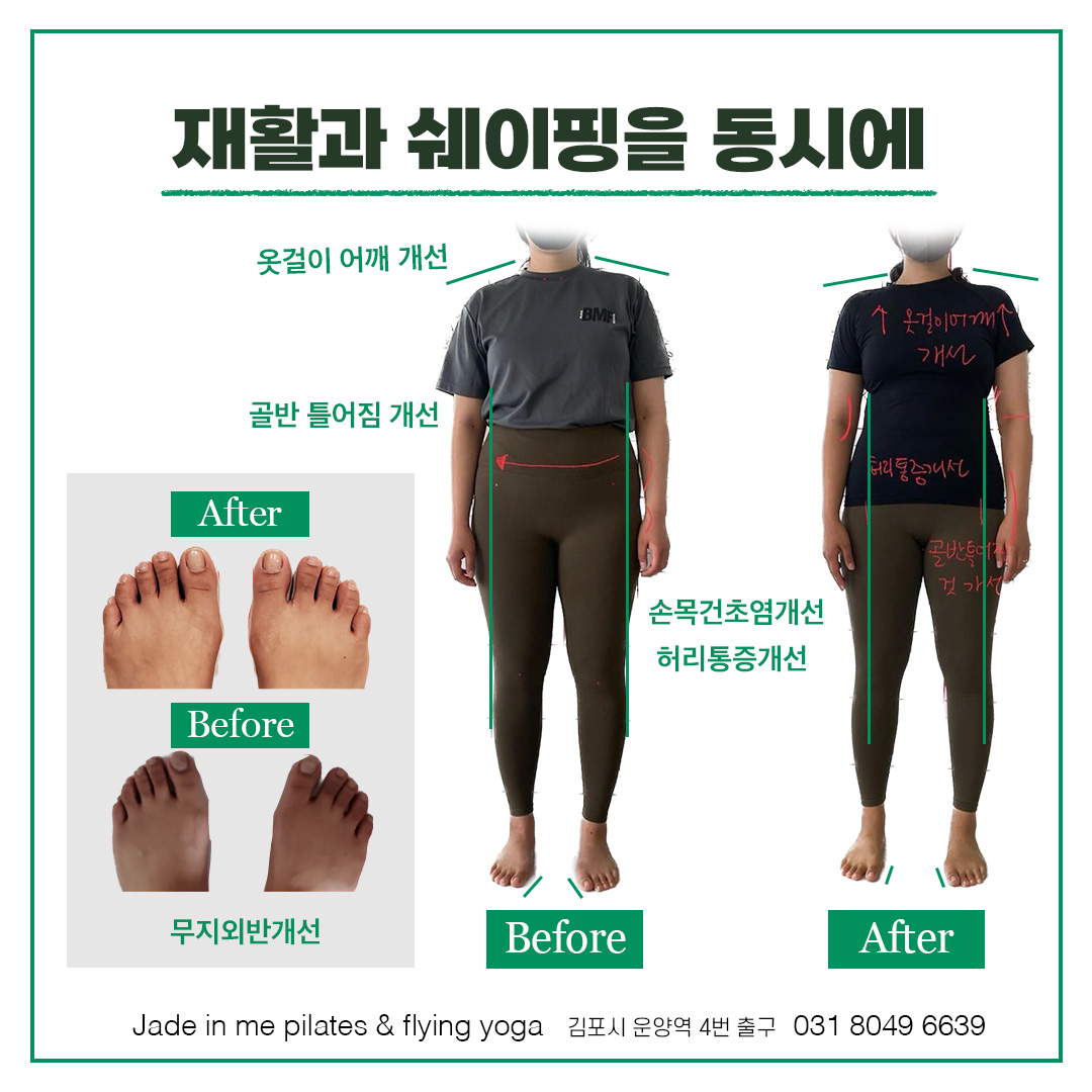 운양동 제이드인미 재활 필라테스 대표 이미지