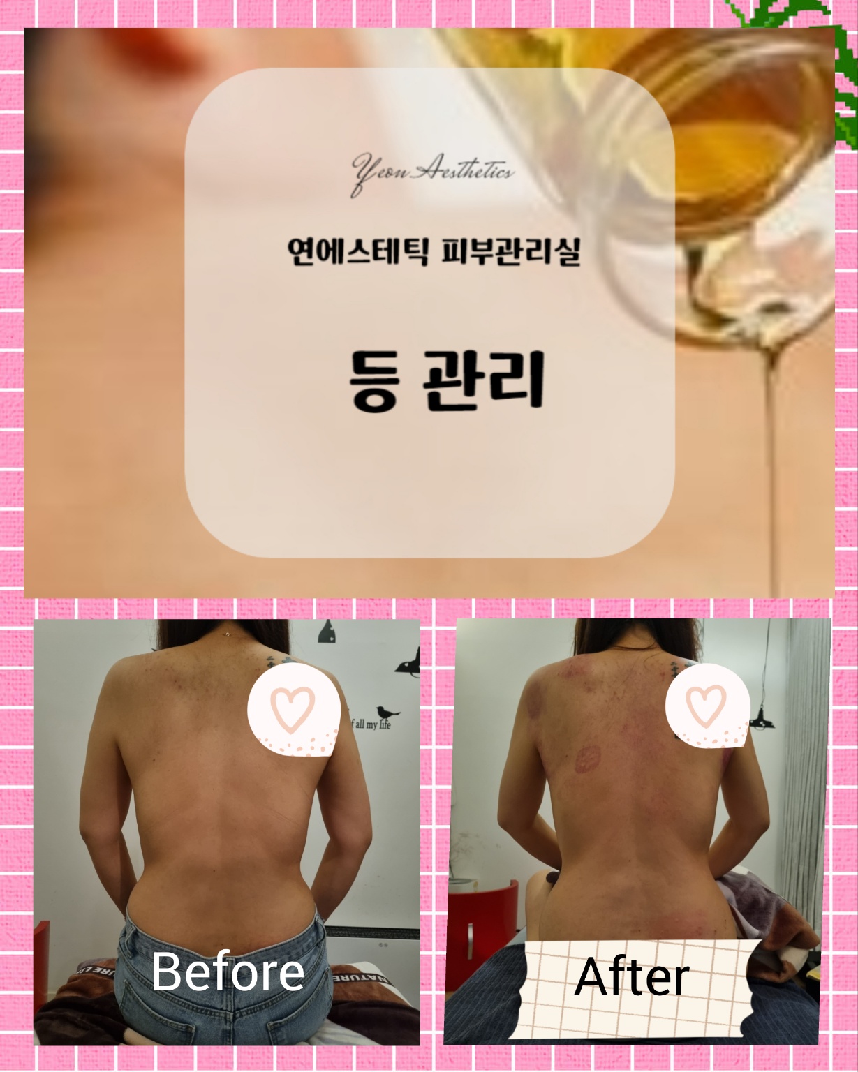 연에스테틱