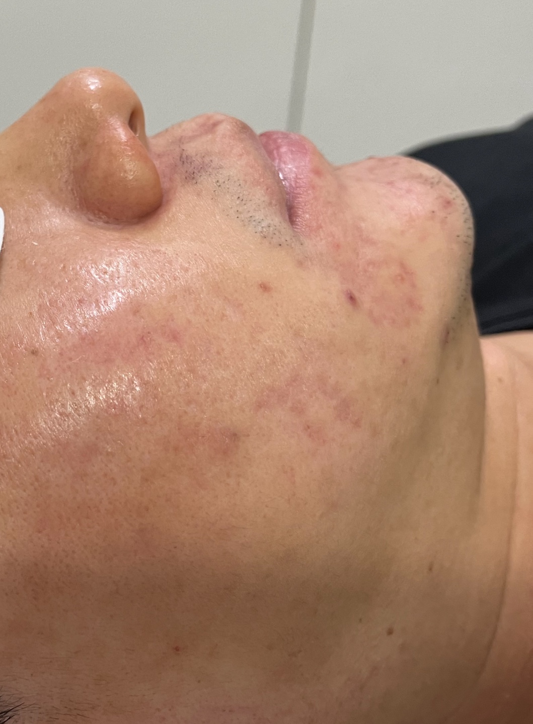 제로스킨 홍대 대표 이미지