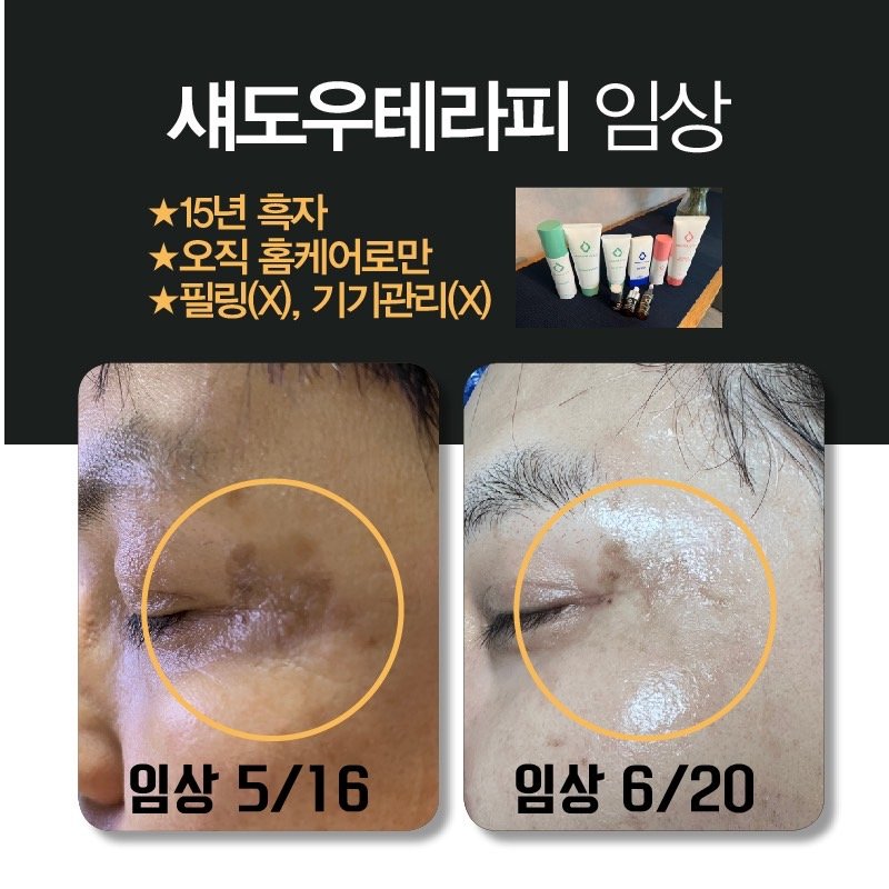 씨엠티커머스
