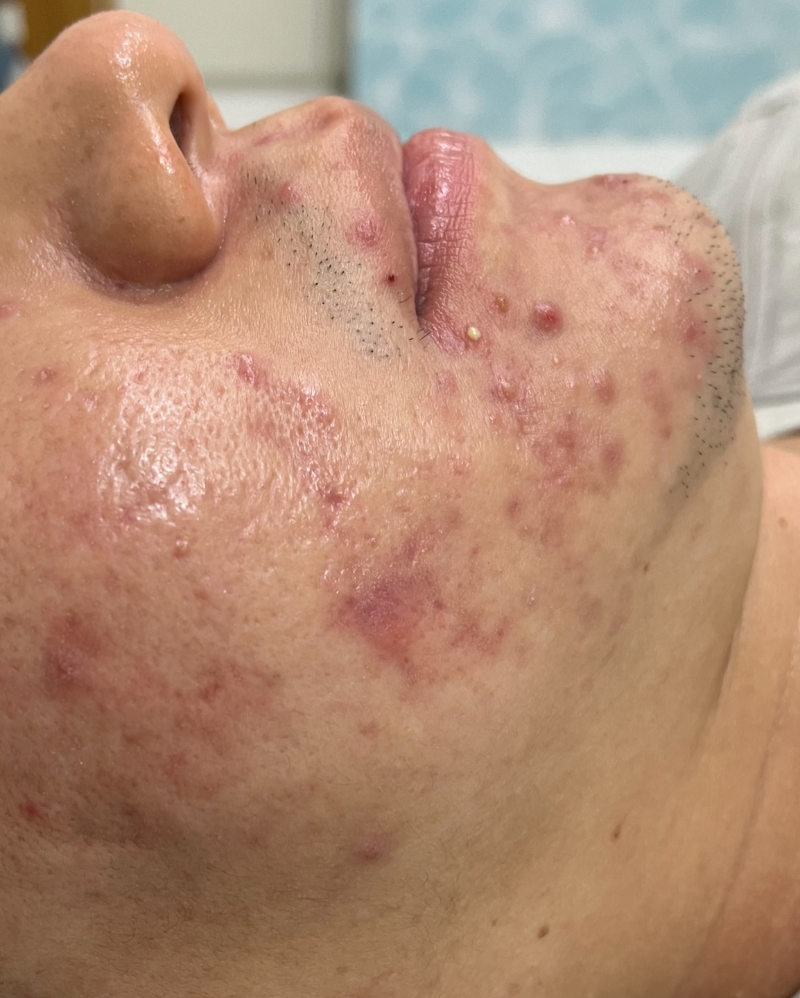 제로스킨 홍대 대표 이미지