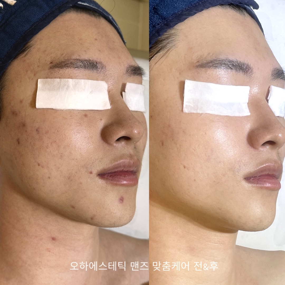 오하에스테틱 부산서면점