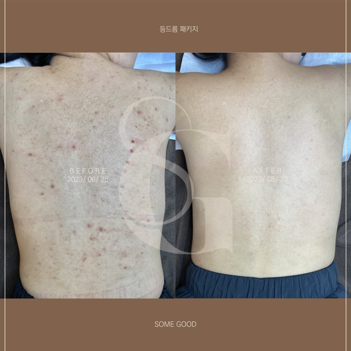 썸굿 대표 이미지