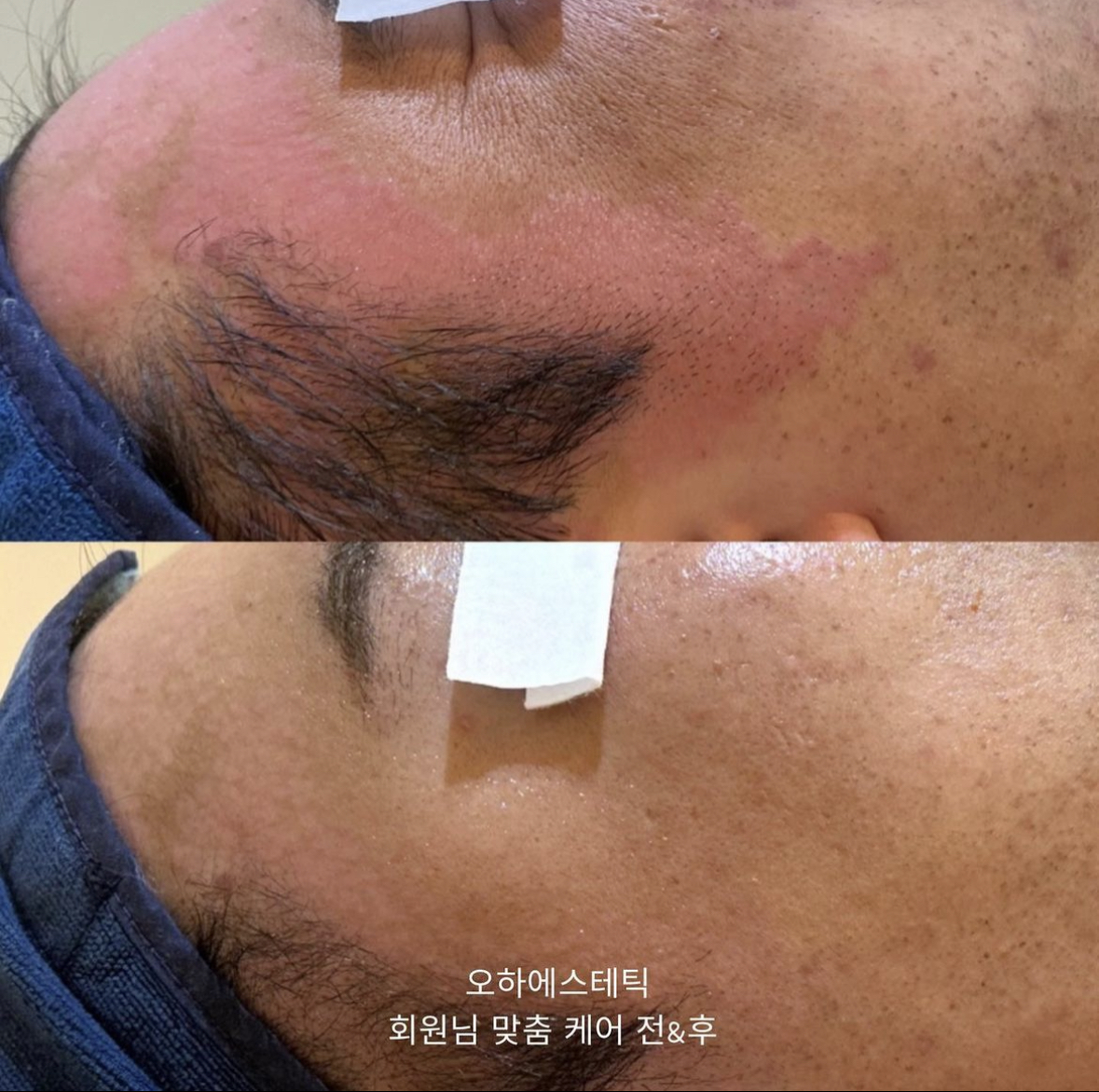 오하에스테틱 대표 이미지