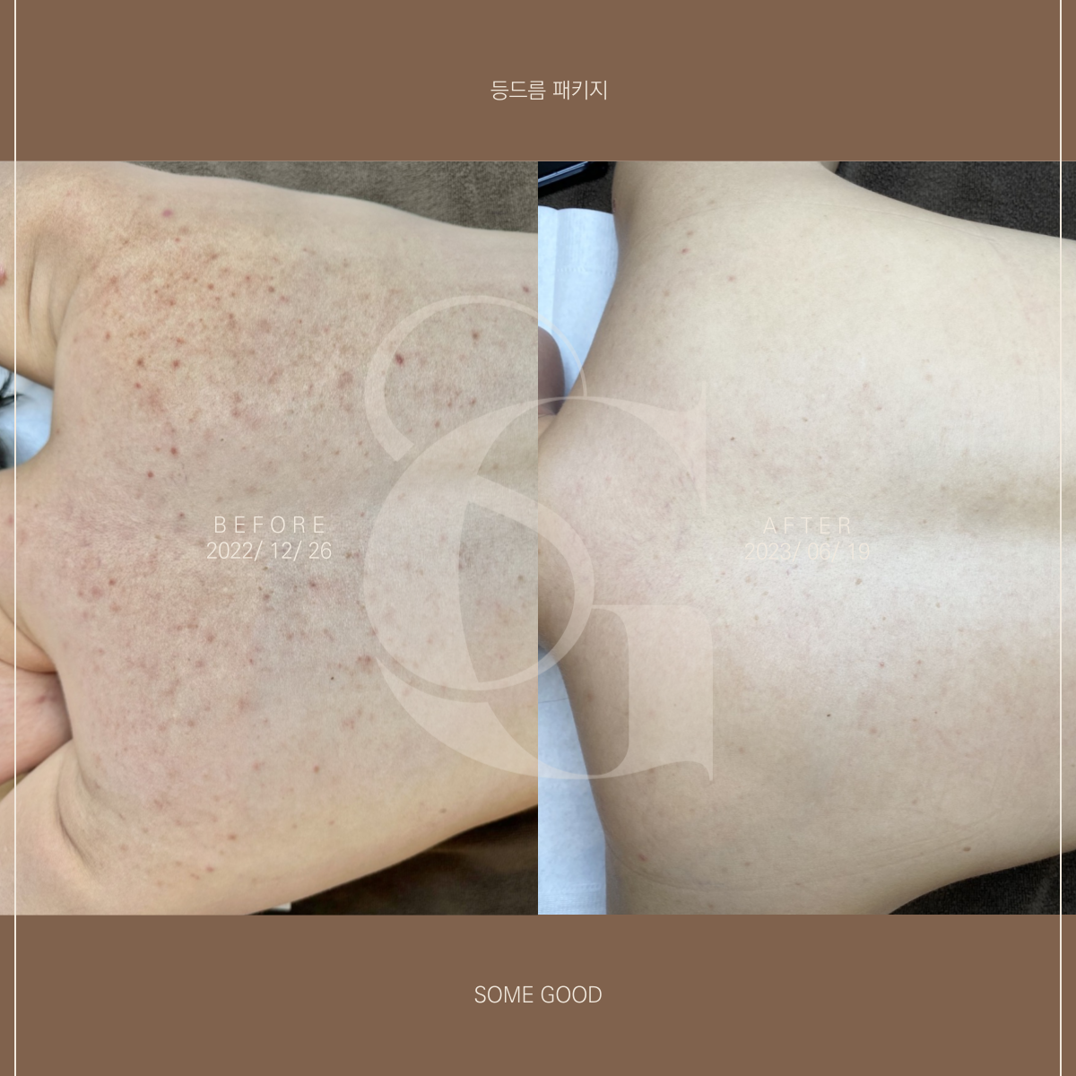 썸굿 대표 이미지