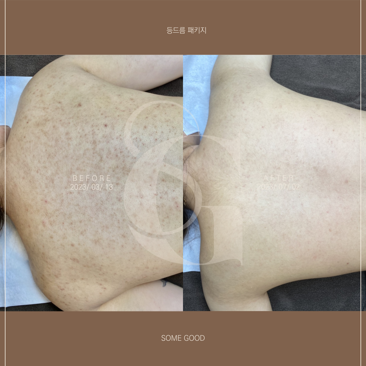 썸굿 대표 이미지