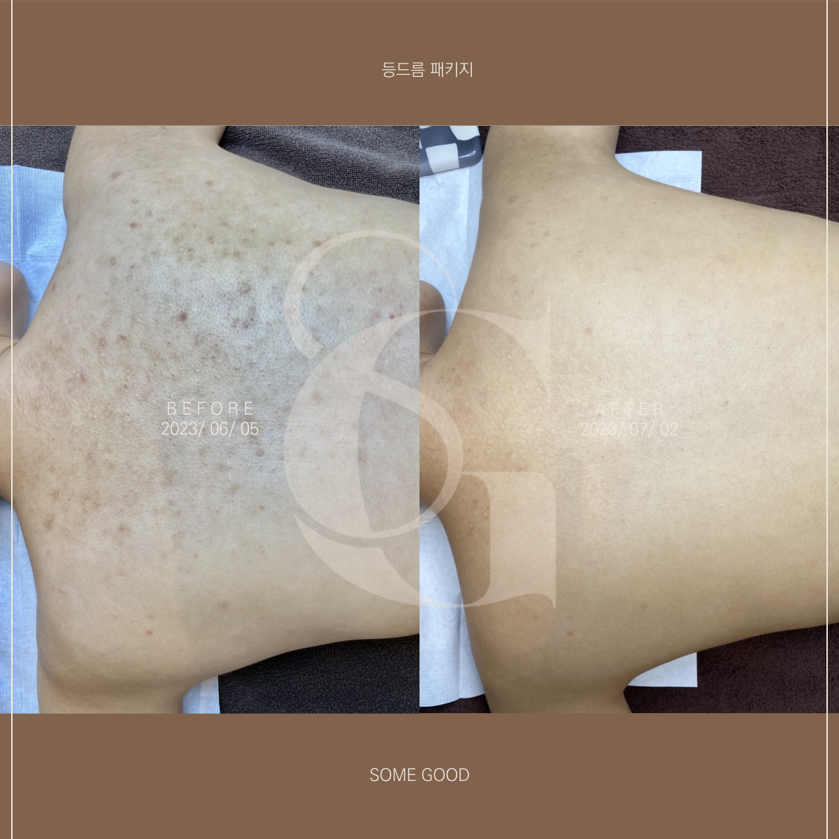 썸굿 대표 이미지