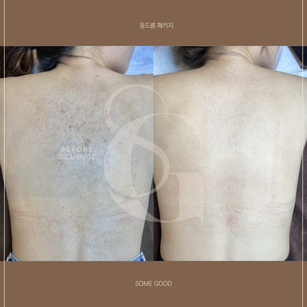 썸굿 대표 이미지