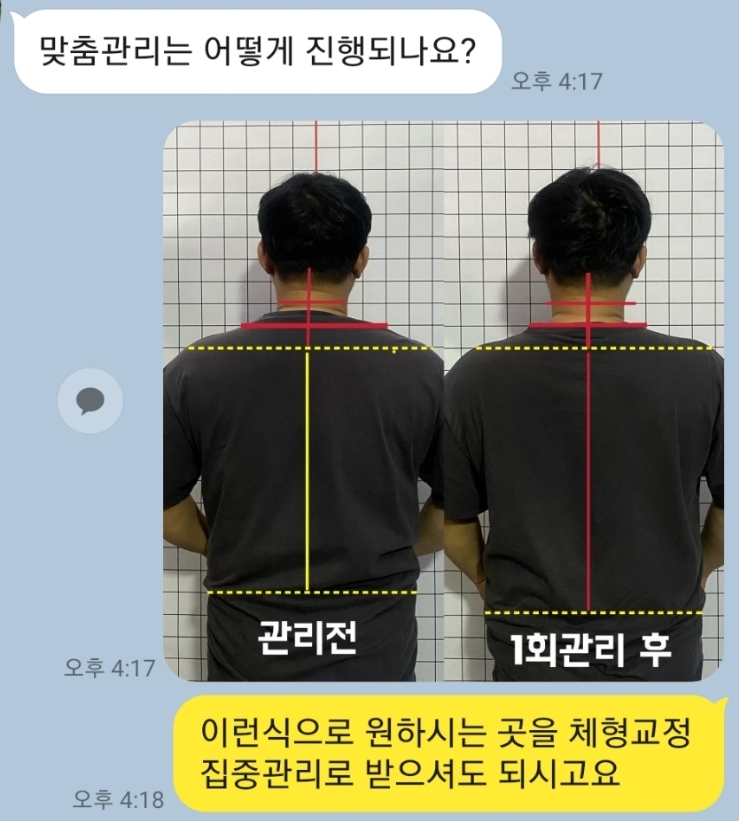 리본바디케어