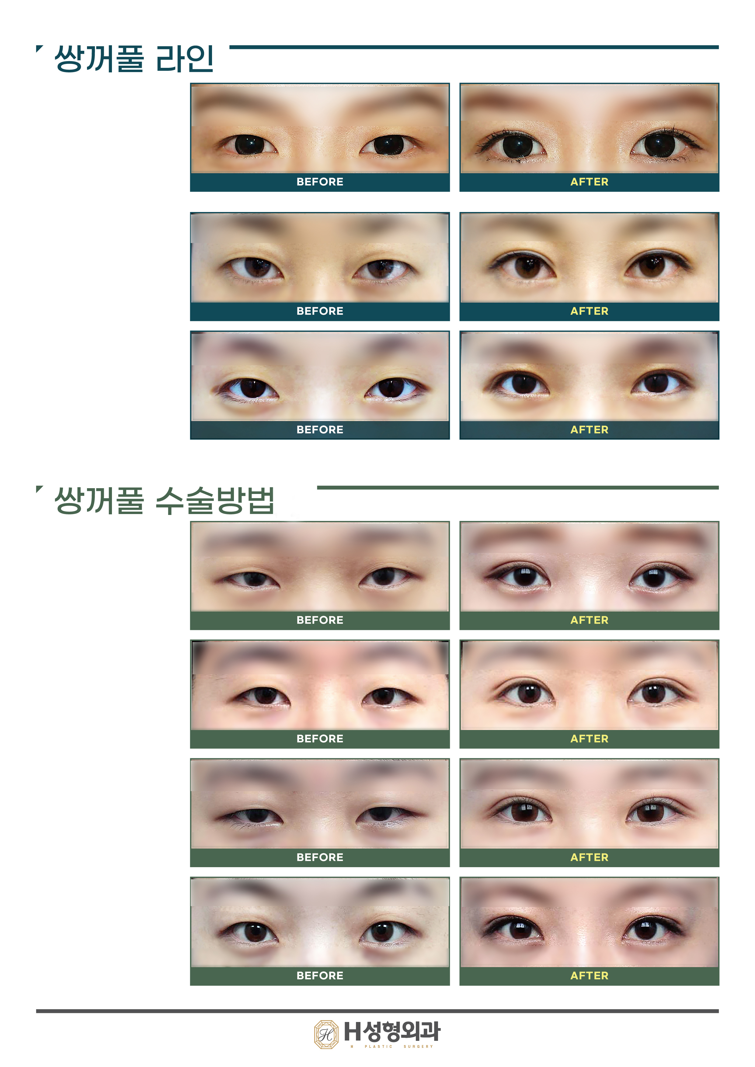 에이치성형외과 대표 이미지