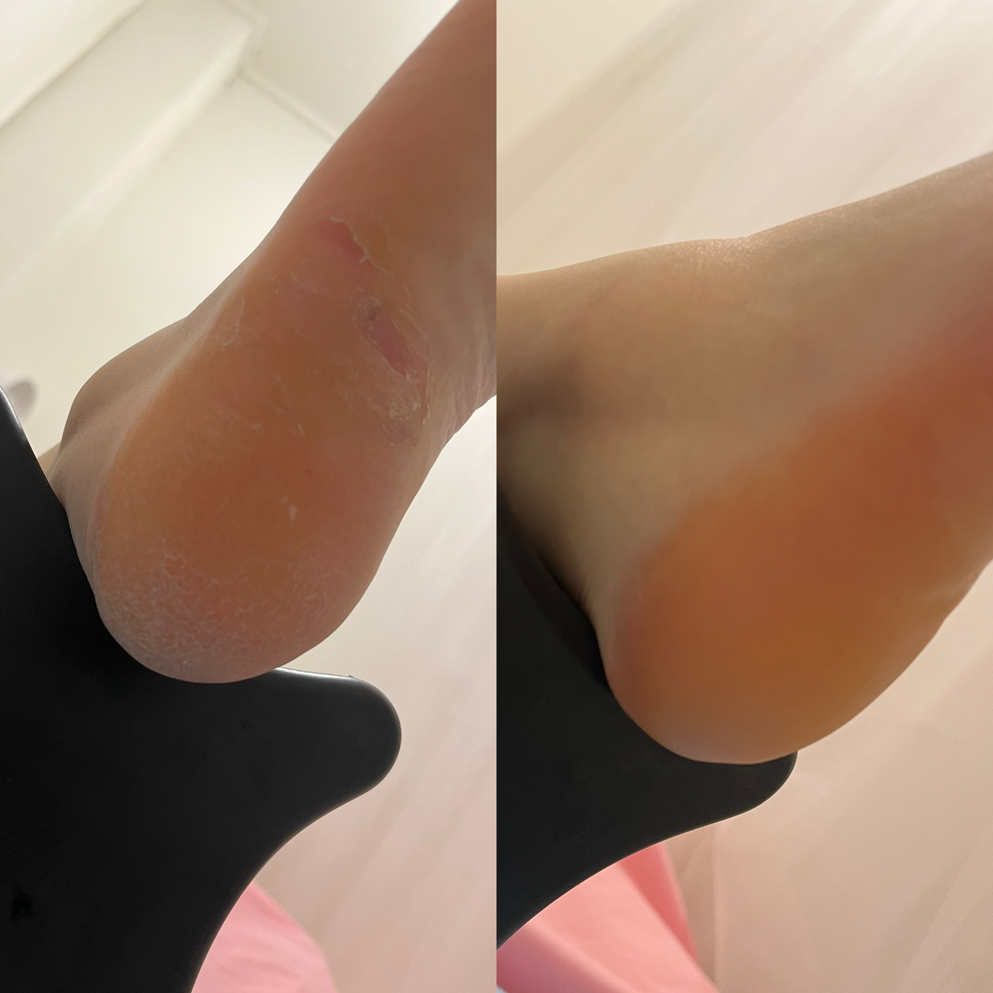 스킨온유 대표 이미지