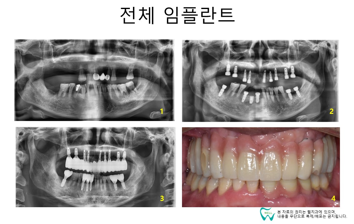 웰치과의원 성남 대표 이미지