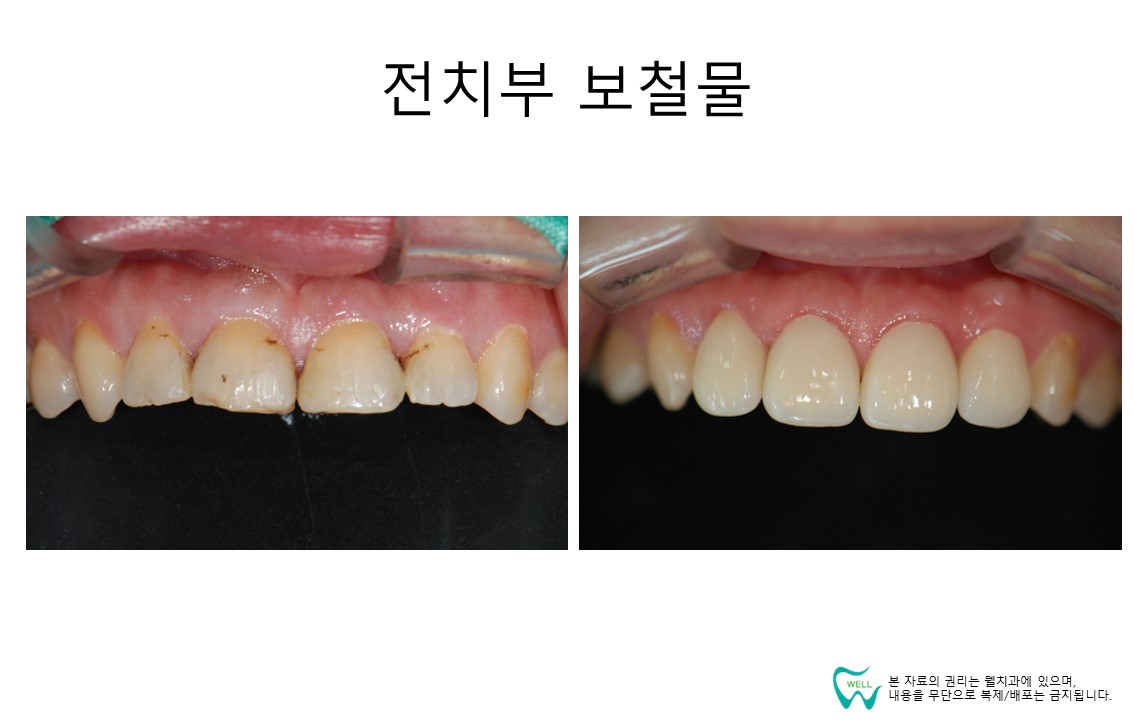 웰치과의원 성남
