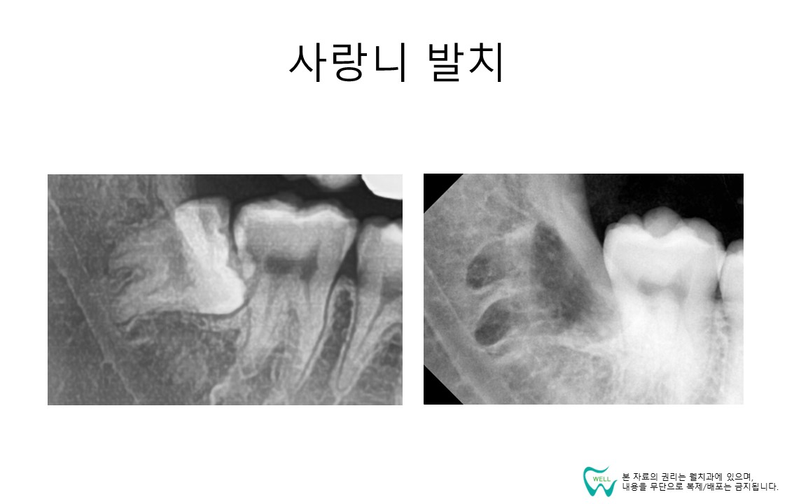 웰치과의원 성남 대표 이미지